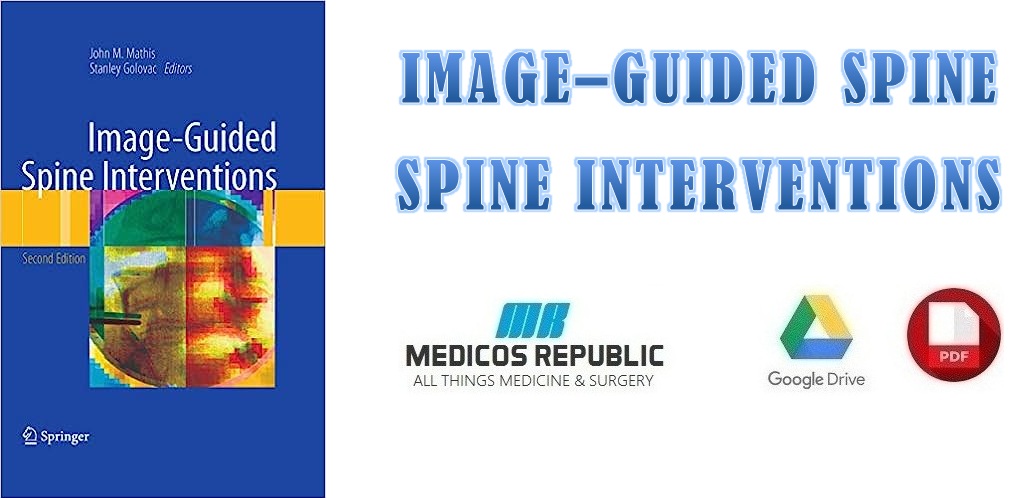 Image-Guided Spine Interventions PDF