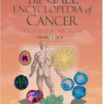 The Gale Encyclopedia Of Cancer A Guide To Cancer And Its Treatments 2nd Edition PDF