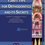 1001 Tips For Orthodontics And Its Secrets PDF