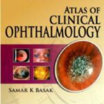 Atlas of Clinical Ophthalmology 2nd Edition PDF