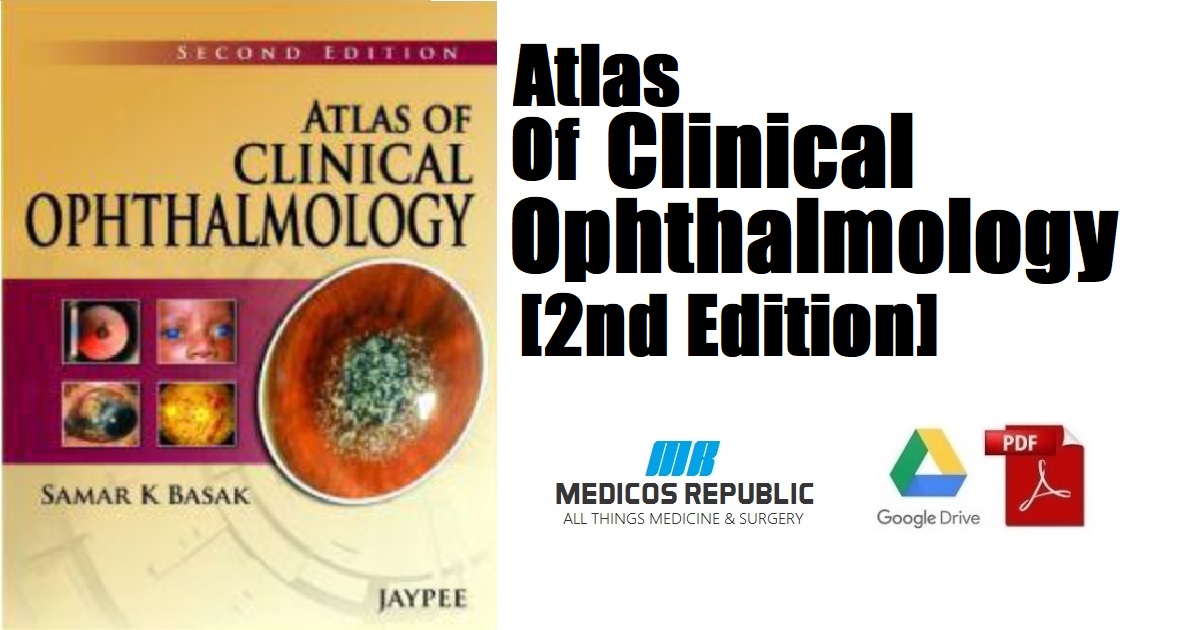 Atlas of Clinical Ophthalmology 2nd Edition PDF