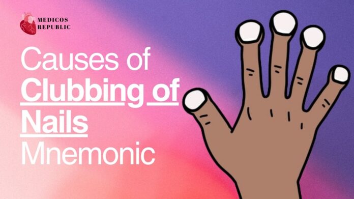 Causes of Clubbing of Nails Mnemonic