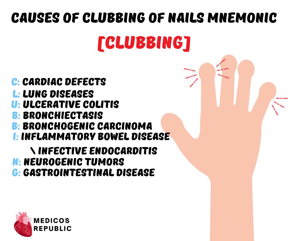 Causes of Clubbing of Nails Mnemonic