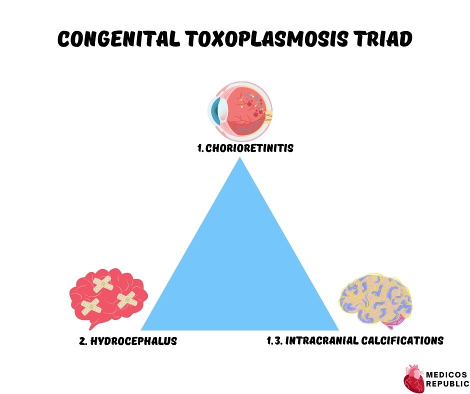 Congenital Toxoplasmosis Triad