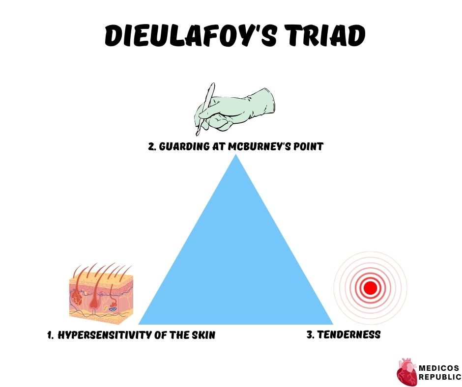 Dieulafoy's Triad for Acute Appendicitis