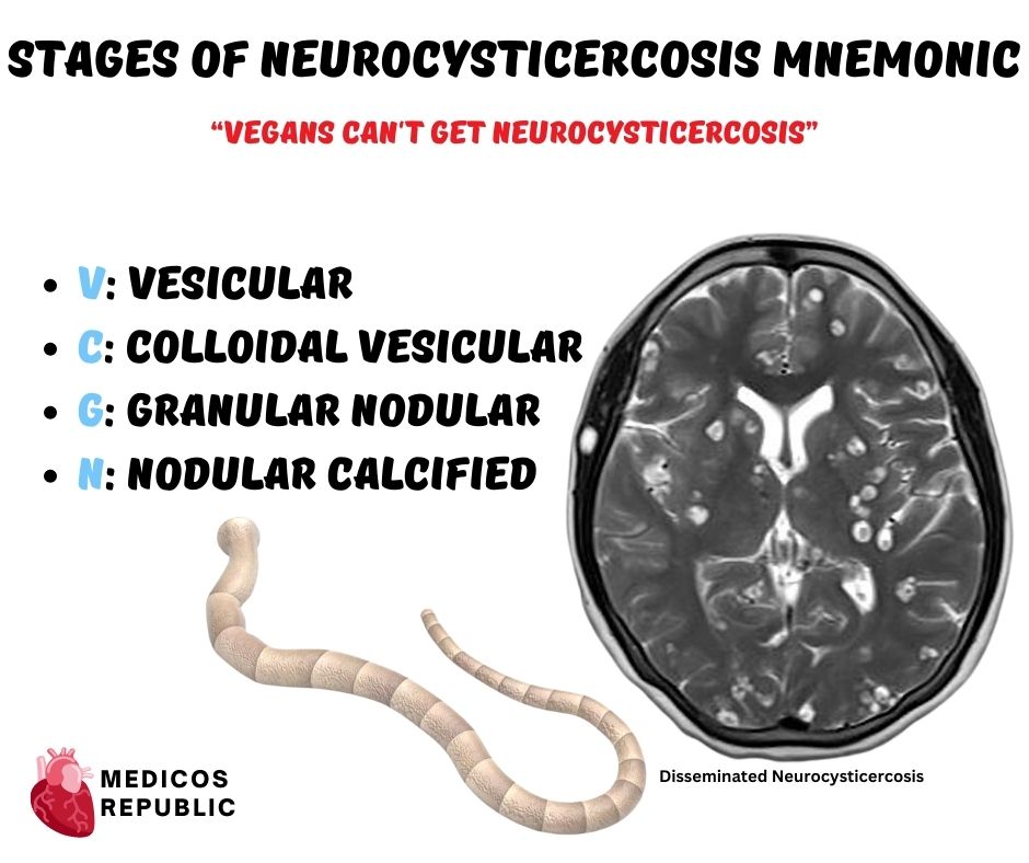 Stages of Neurocysticercosis Mnemonic