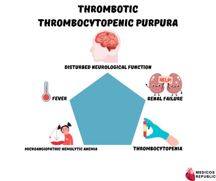 Pentad of Thrombotic Thrombocytopenic Purpura [Pictorial & High-yield]