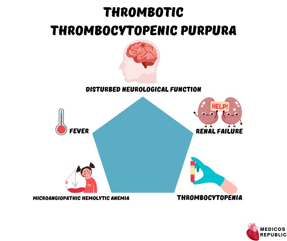 Pentad of Thrombotic Thrombocytopenic Purpura