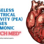 Pulseless Electrical Activity (PEA) Causes Mnemonic