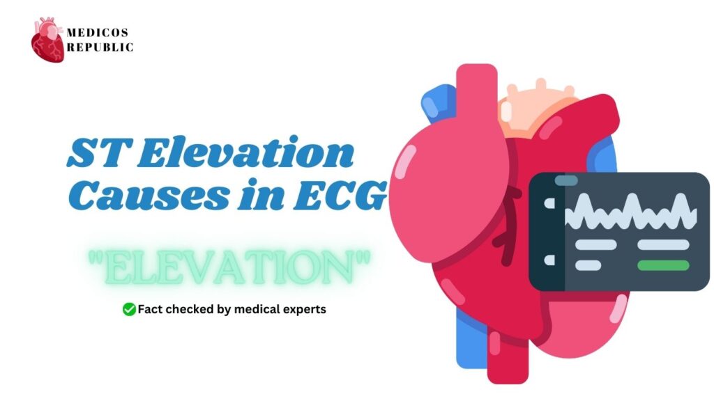 ST Elevation Causes in ECG Mnemonic: "ELEVATION"