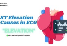 ST Elevation Causes in ECG Mnemonic