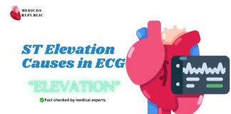 ST Elevation Causes in ECG Mnemonic