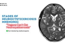 Stages of Neurocysticercosis Mnemonic