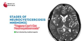 Stages of Neurocysticercosis Mnemonic