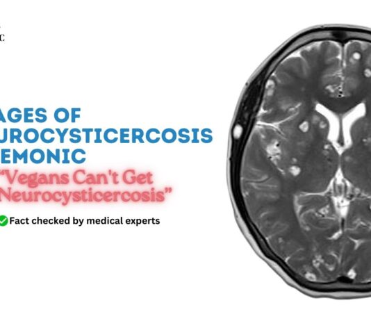 Stages of Neurocysticercosis Mnemonic