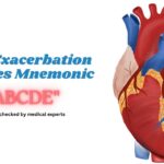 Supraventricular Tachycardia Treatment Mnemonic