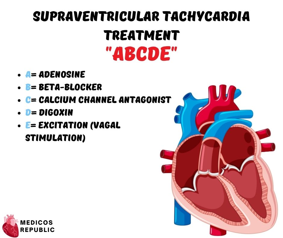 Supraventricular Tachycardia Treatment Mnemonic