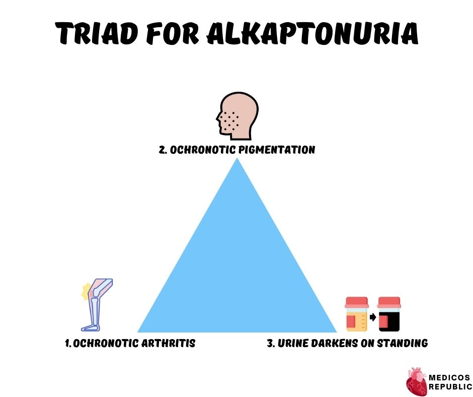 Alkaptonuria Triad