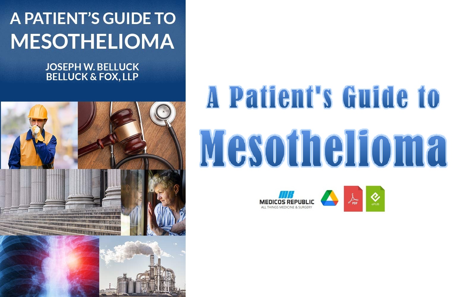 A Patient's Guide to Mesothelioma PDF