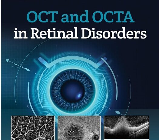 OCT and OCTA in Retinal Disorders PDF
