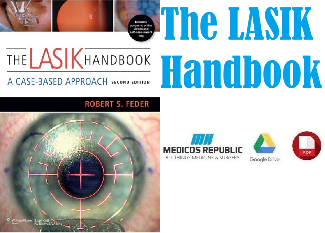 The LASIK Handbook A Case-Based Approach PDF 