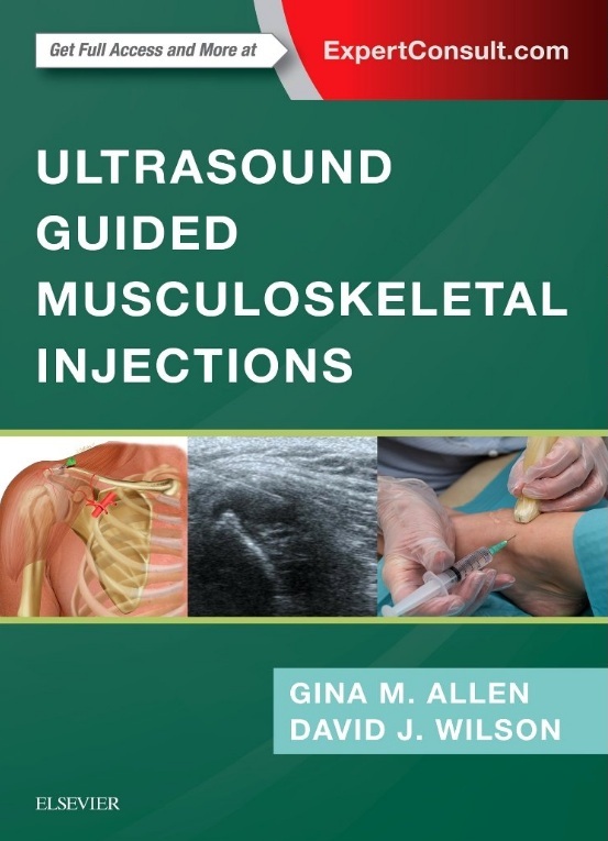 Ultrasound Guided Musculoskeletal Injections PDF