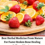 Best Herbal Medicine From Nature For Faster Broken Bone Healing PDF