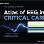 Hirsch and Brenner's Atlas of EEG in Critical Care PDF