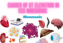 Causes of ST Elevation in ECG Mnemonic