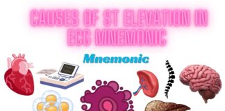 Causes of ST Elevation in ECG Mnemonic