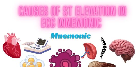 Causes of ST Elevation in ECG Mnemonic Archives | Medicos Republic