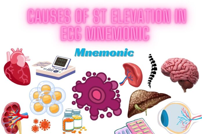 Causes of ST Elevation in ECG Mnemonic