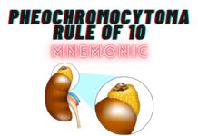Pheochromocytoma Rule of 10 Mnemonic