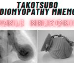 Takotsubo Cardiomyopathy Mnemonic