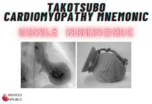 Takotsubo Cardiomyopathy Mnemonic