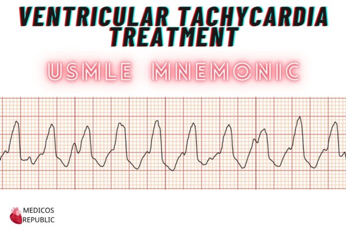 Ventricular Tachycardia Treatment Mnemonic