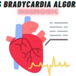 ACLS Bradycardia Algorithm Mnemonic