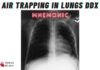 Air trapping in lungs differentials mnemonic
