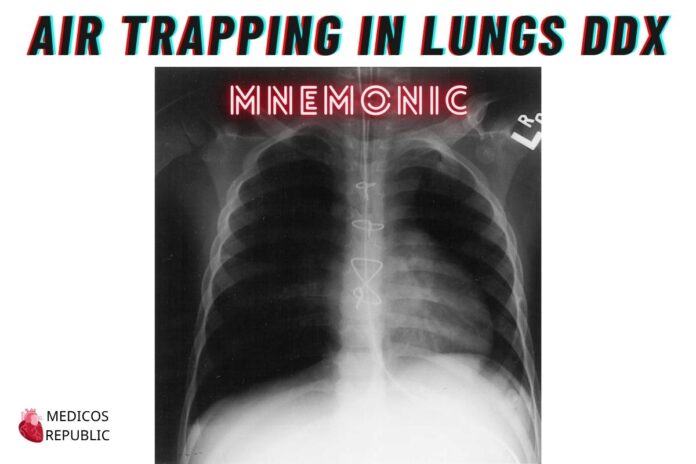 Air trapping in lungs differentials mnemonic