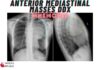 Anterior Mediastinal Masses DDx Mnemonic