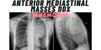 Anterior Mediastinal Masses DDx Mnemonic