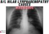 Bilateral Hilar Lymphadenopathy Causes Mnemonic