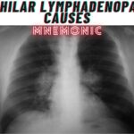 Bilateral Hilar Lymphadenopathy Causes Mnemonic