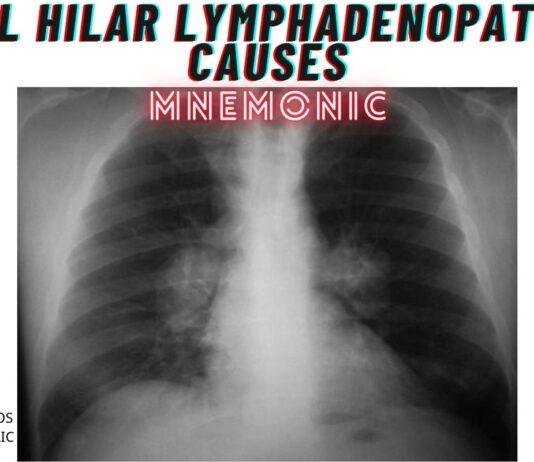 Bilateral Hilar Lymphadenopathy Causes Mnemonic