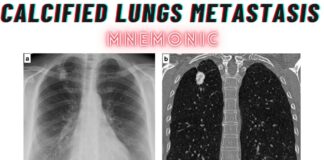 Calcified Lungs Metastasis Differentials Mnemonic