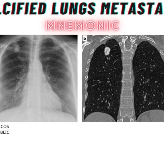 Calcified Lungs Metastasis Differentials Mnemonic