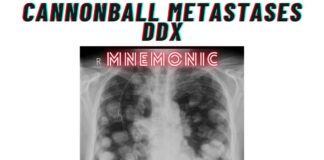 Cannonball Metastases DDx Mnemonic