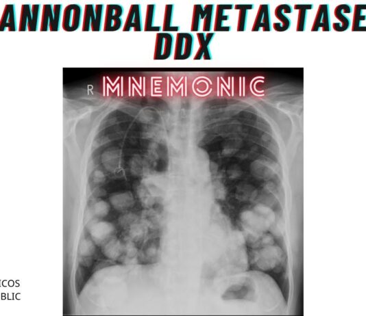 Cannonball Metastases DDx Mnemonic