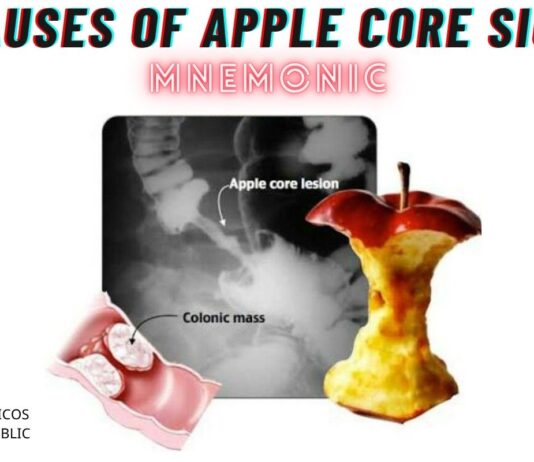 Causes of Apple Core Sign Mnemonic