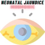 Causes of Neonatal Jaundice Mnemonic: “J.A.U.N.D.I.C.E”